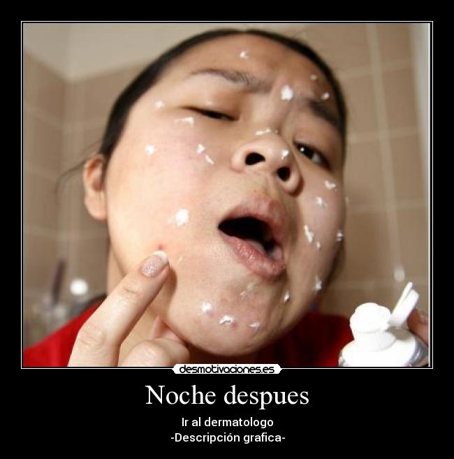 Noche despues - 