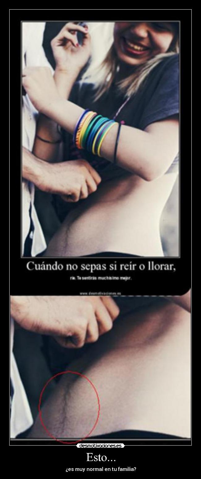 Esto... - 