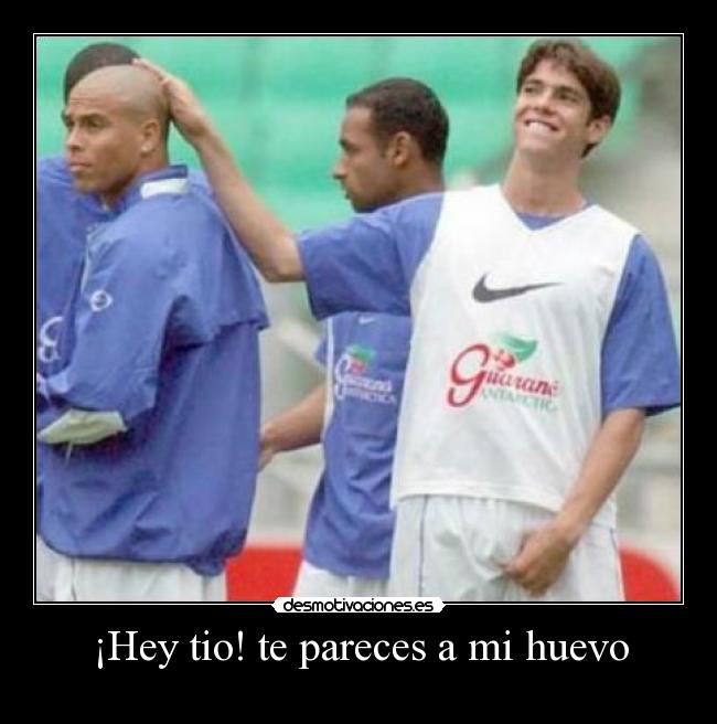 ¡Hey tio! te pareces a mi huevo - 