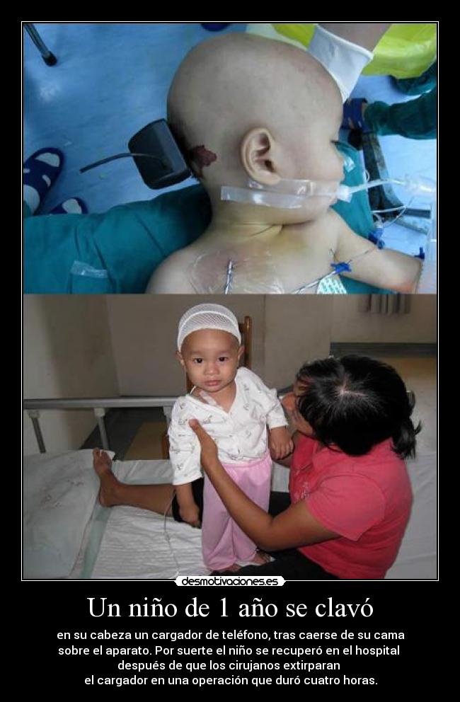 Un niño de 1 año se clavó - 