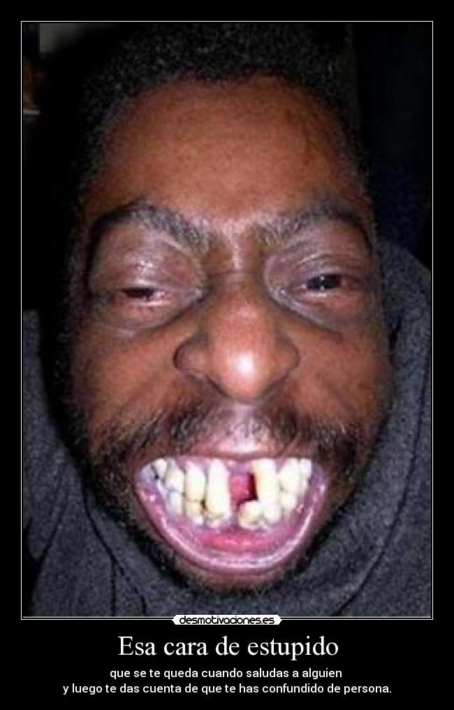 Esa cara de estupido -