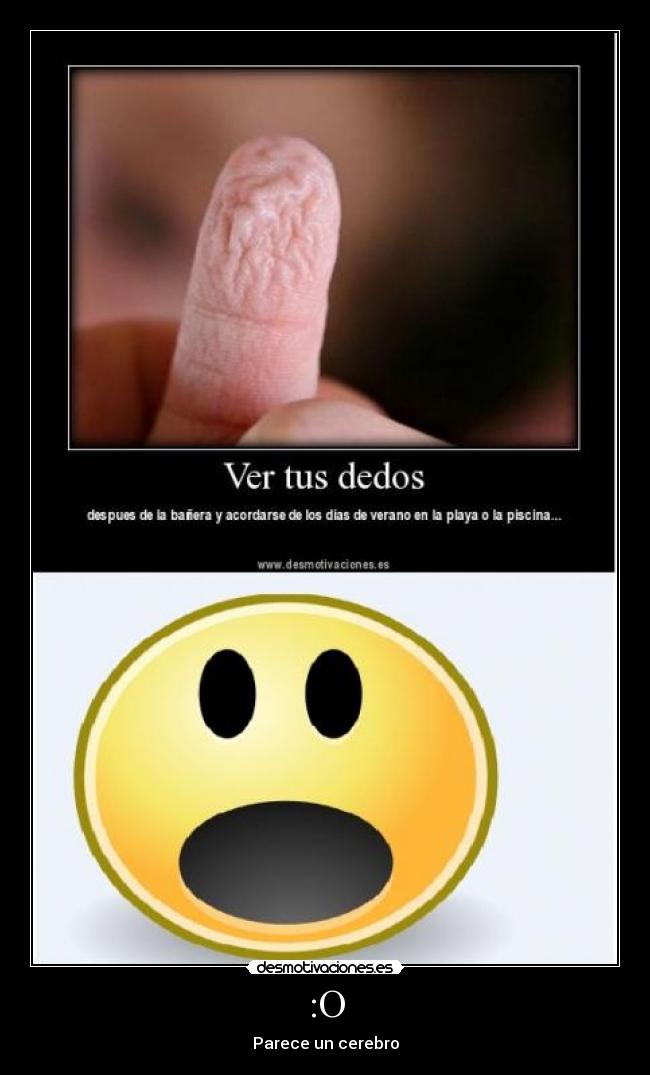 :O - Parece un cerebro