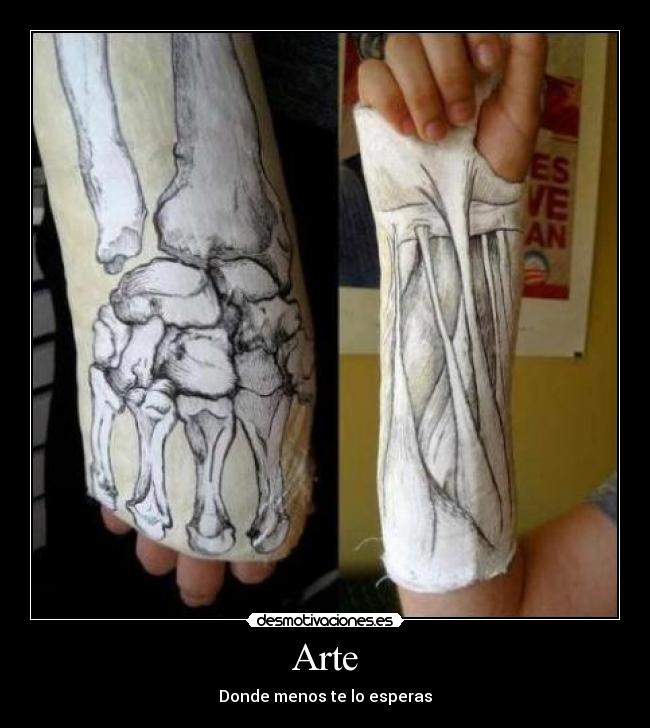 Arte - 