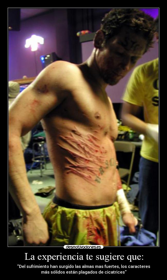 La experiencia te sugiere que: - Del sufrimiento han surgido las almas mas fuertes, los caracteres
más sólidos están plagados de cicatrices