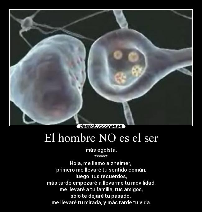El hombre NO es el ser - más egoísta.
******
Hola, me llamo alzheimer, 
primero me llevaré tu sentido común,
luego  tus recuerdos,
más tarde empezaré a llevarme tu movilidad,
me llevaré a tu familia, tus amigos,
sólo te dejaré tu pasado, 
me llevaré tu mirada, y más tarde tu vida.