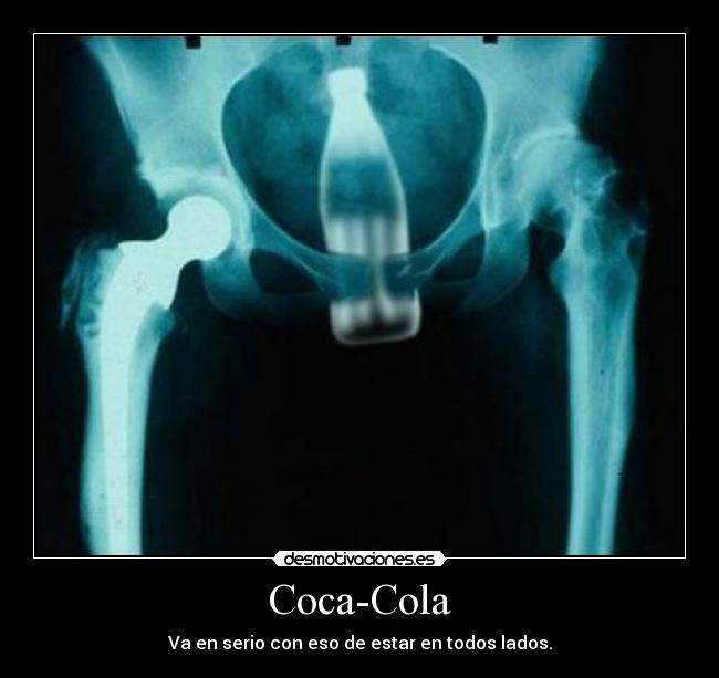 Coca-Cola - Va en serio con eso de estar en todos lados.