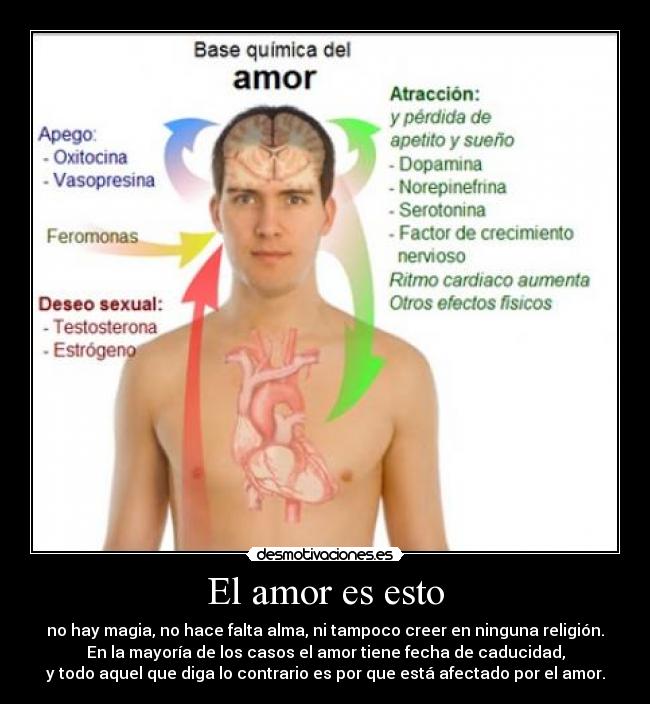 El amor es esto - 