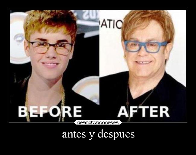 antes y despues - 