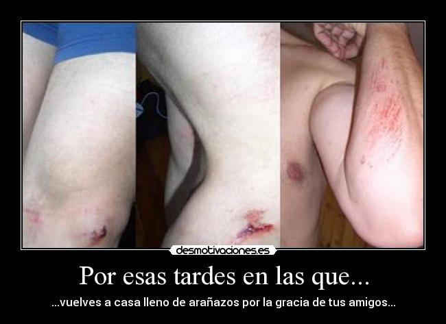 Por esas tardes en las que... - ...vuelves a casa lleno de arañazos por la gracia de tus amigos...