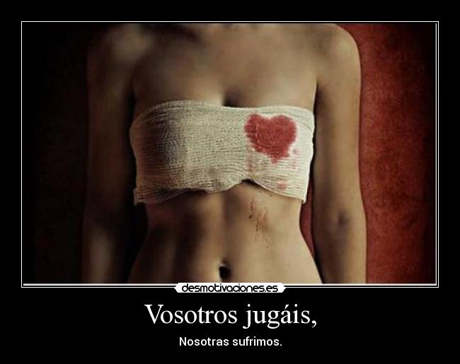Vosotros jugáis, -
