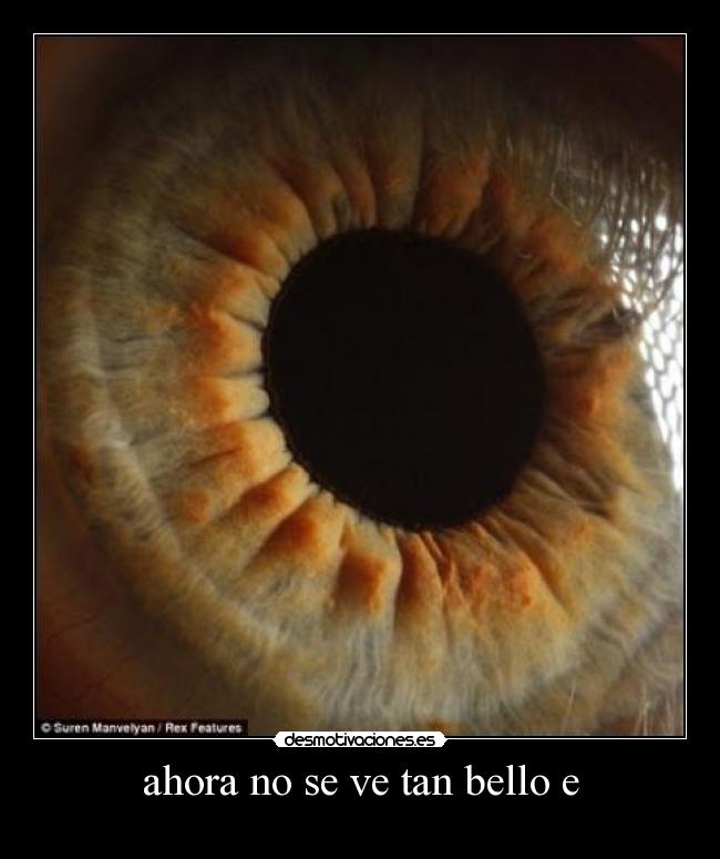 ahora no se ve tan bello e -