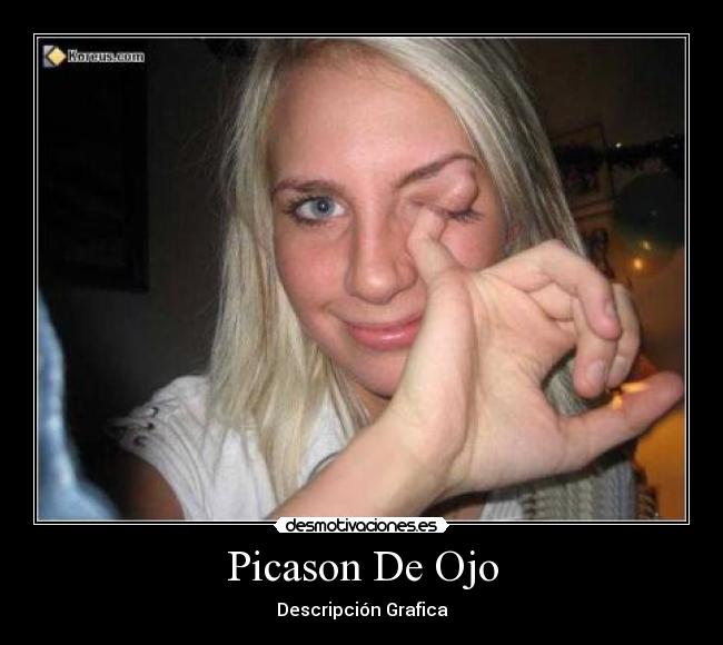 Picason De Ojo -
