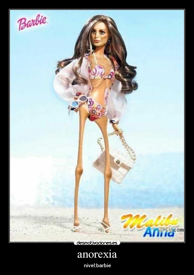 anorexia - nivel:barbie