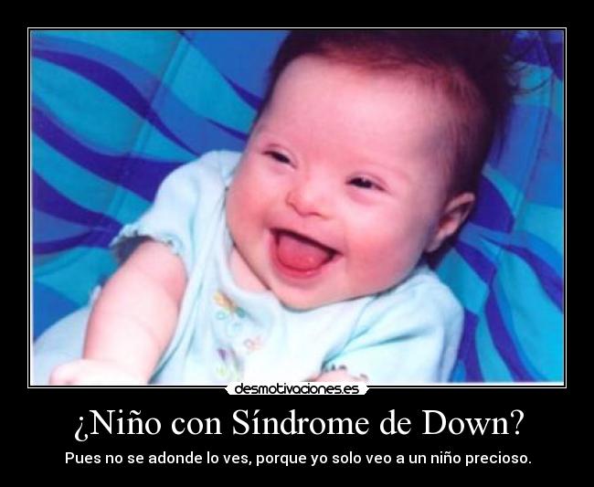 ¿Niño con Síndrome de Down? - Pues no se adonde lo ves, porque yo solo veo a un niño precioso.