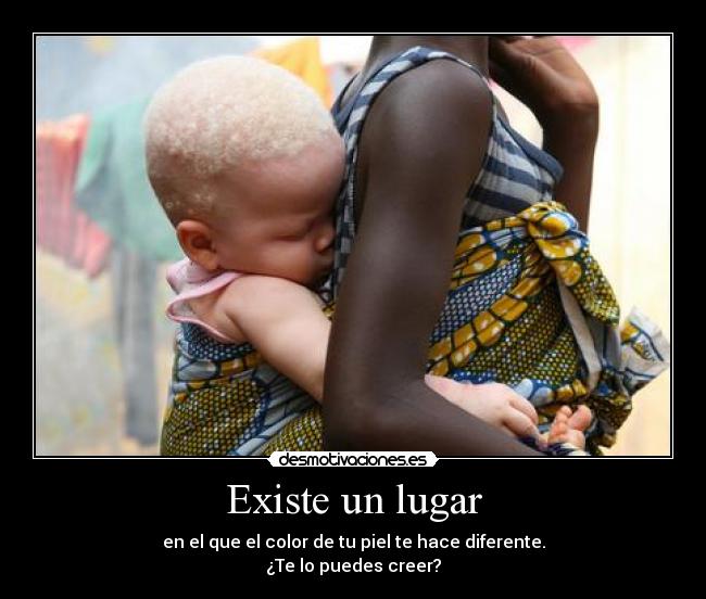 Existe un lugar - en el que el color de tu piel te hace diferente.
¿Te lo puedes creer?