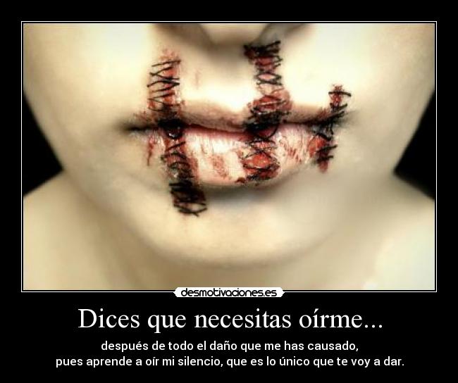 Dices que necesitas oírme... - después de todo el daño que me has causado,
pues aprende a oír mi silencio, que es lo único que te voy a dar.