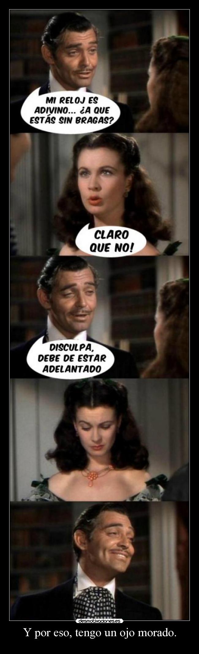 Y por eso, tengo un ojo morado. - 