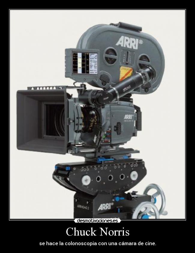 Chuck Norris - se hace la colonoscopia con una cámara de cine.