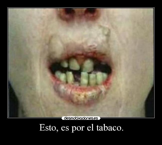 Esto, es por el tabaco. -