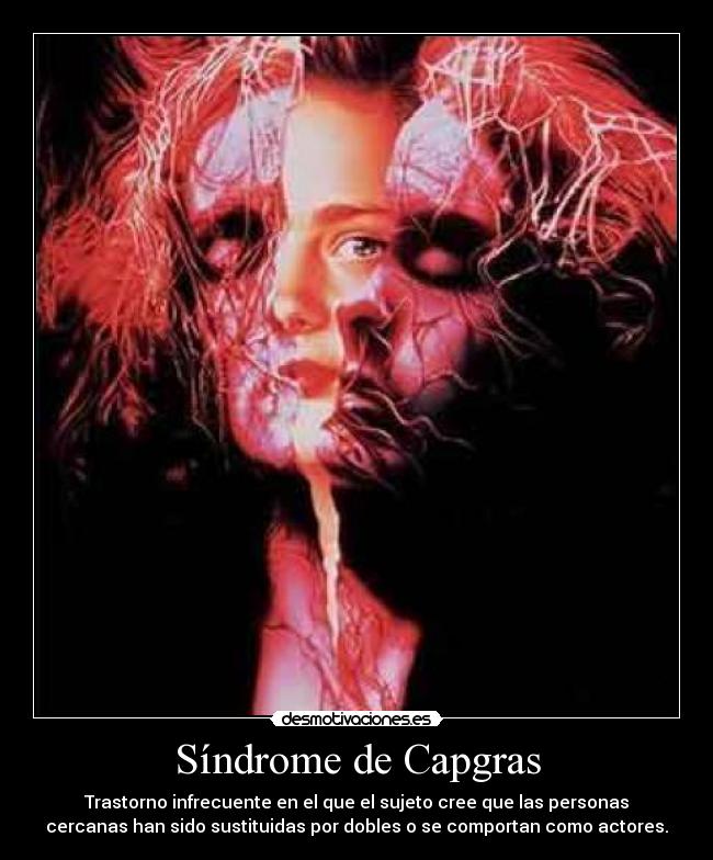 Síndrome de Capgras - 