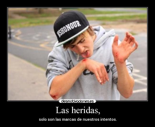Las heridas, - solo son las marcas de nuestros intentos.