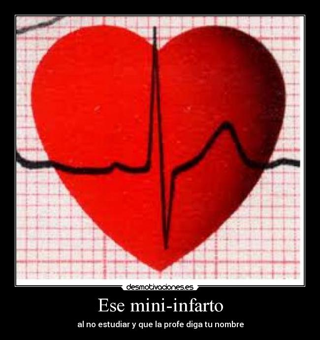 Ese mini-infarto -