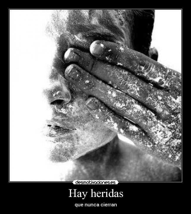 Hay heridas - 