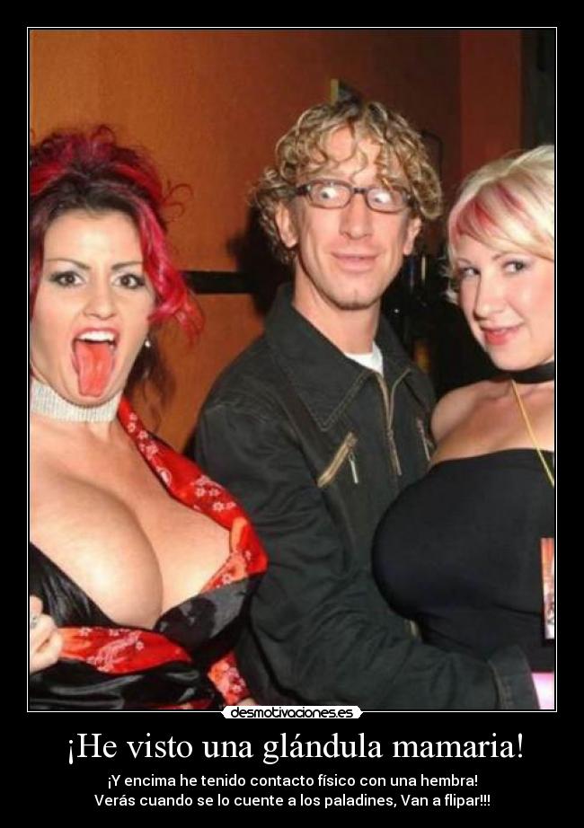 ¡He visto una glándula mamaria! - ¡Y encima he tenido contacto físico con una hembra!
Verás cuando se lo cuente a los paladines, Van a flipar!!!