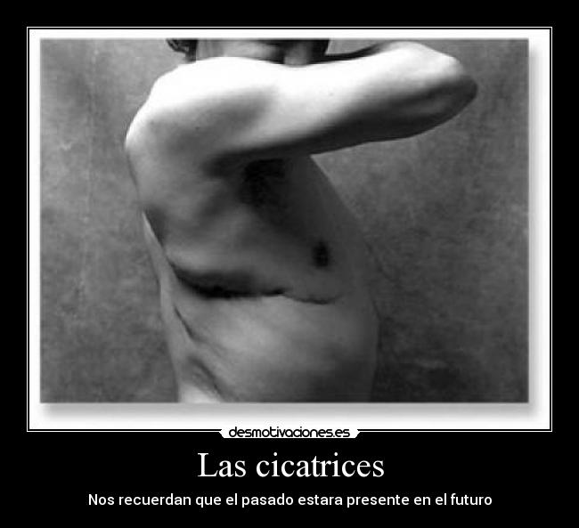 Las cicatrices - 