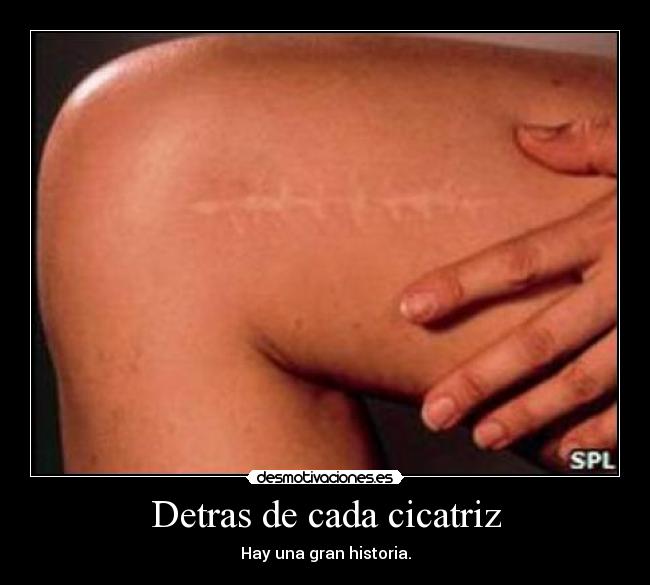 Detras de cada cicatriz - Hay una gran historia.