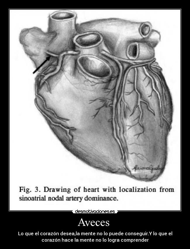 Aveces  - Lo que el corazón desea,la mente no lo puede conseguir.Y lo que el
corazón hace la mente no lo logra comprender