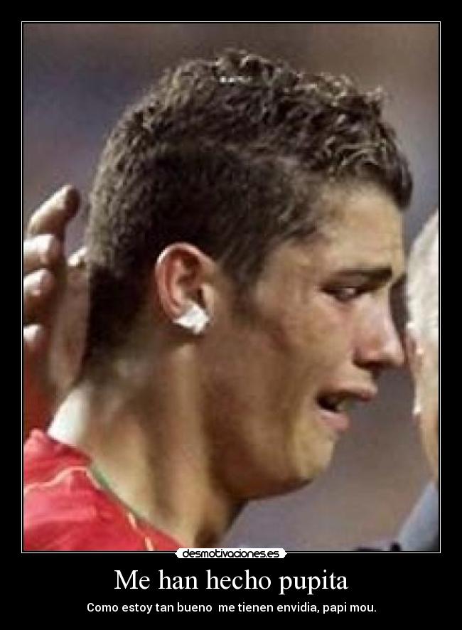 Me han hecho pupita -