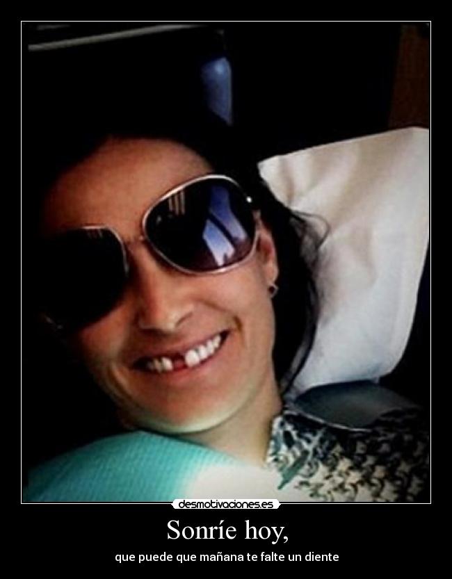 Sonríe hoy, - que puede que mañana te falte un diente