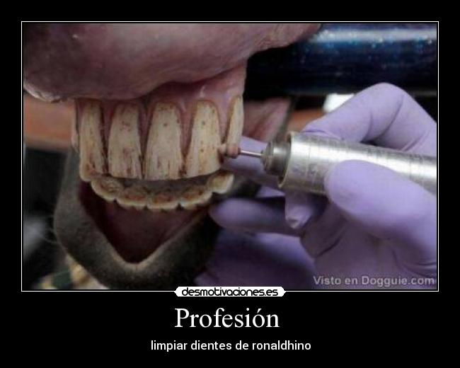 Profesión  - 