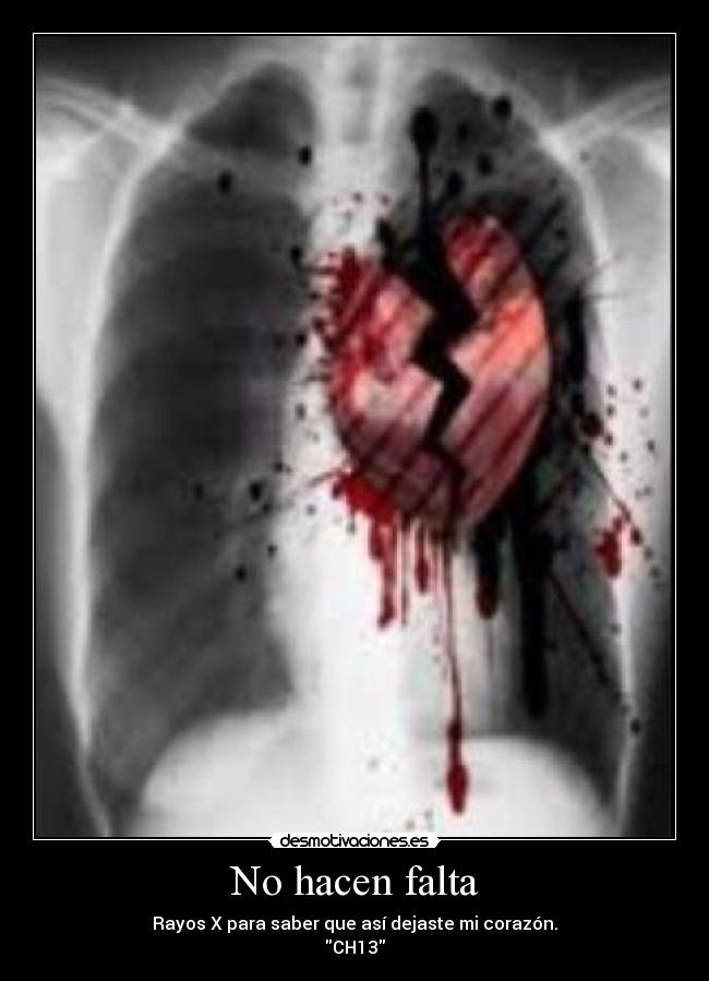 No hacen falta - Rayos X para saber que así dejaste mi corazón.
CH13