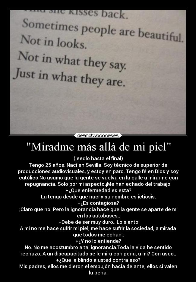 Miradme más allá de mi piel -