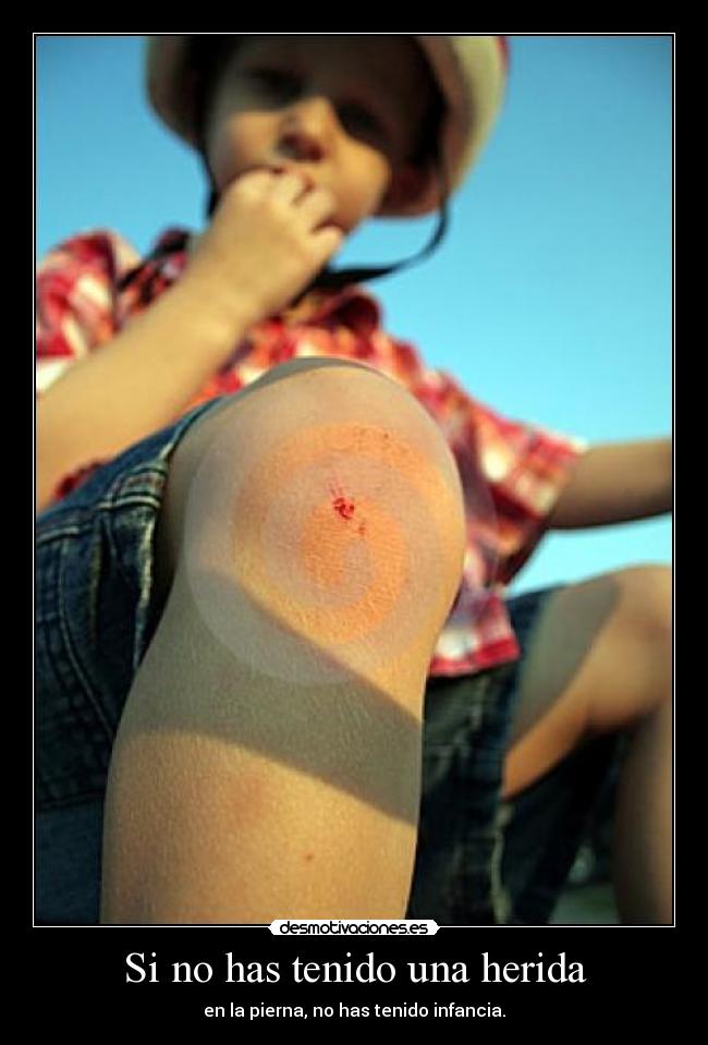 Si no has tenido una herida - en la pierna, no has tenido infancia.