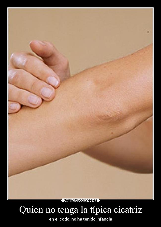 carteles cicatriz codo desmotivaciones