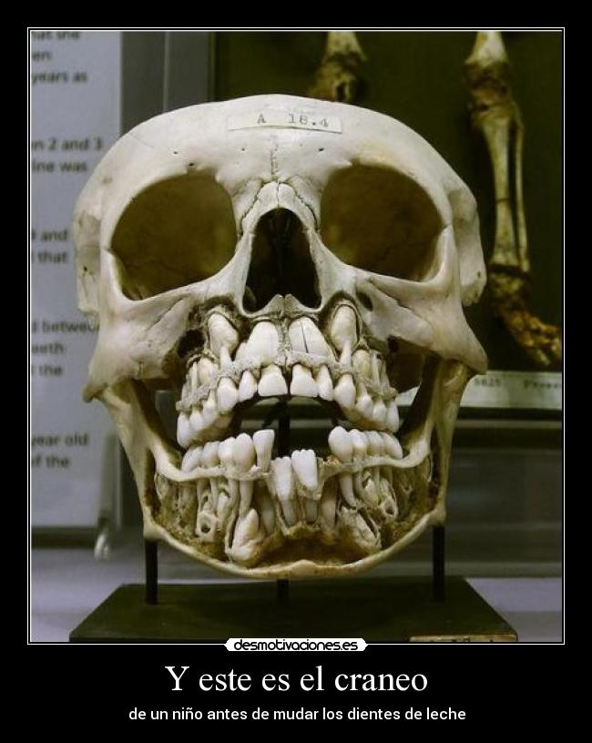 carteles craneo calavera diente dientes dentadura esqueleto hueso calcio anatomia cabeza desmotivaciones