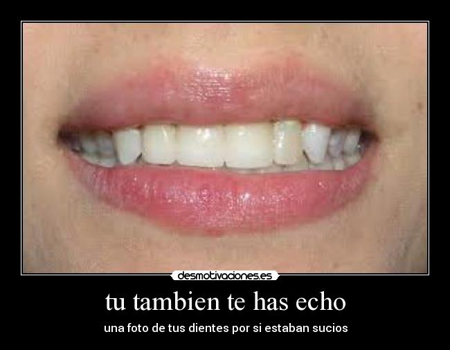 tu tambien te has echo - una foto de tus dientes por si estaban sucios