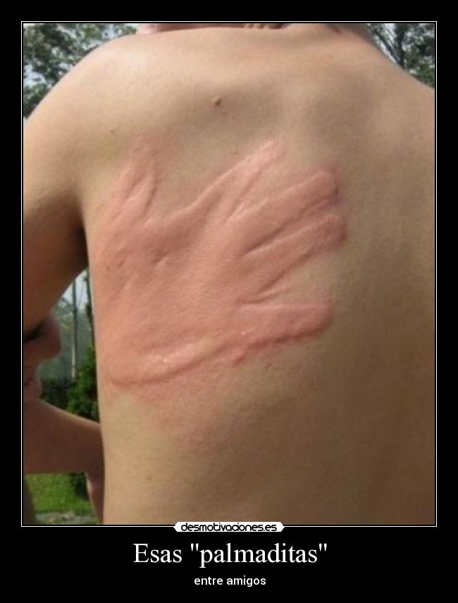 Esas palmaditas - entre amigos