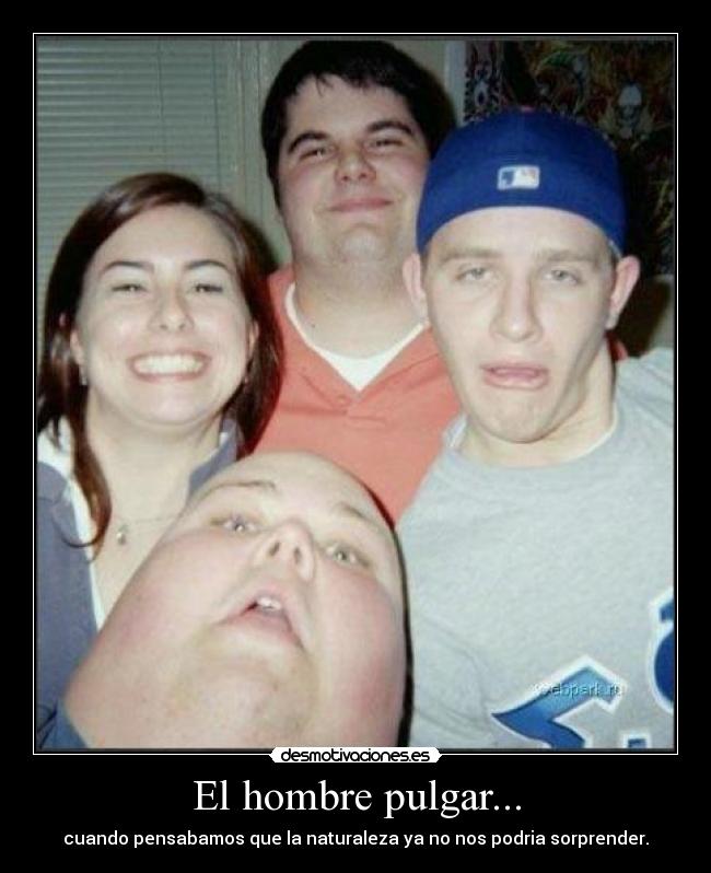 El hombre pulgar... -