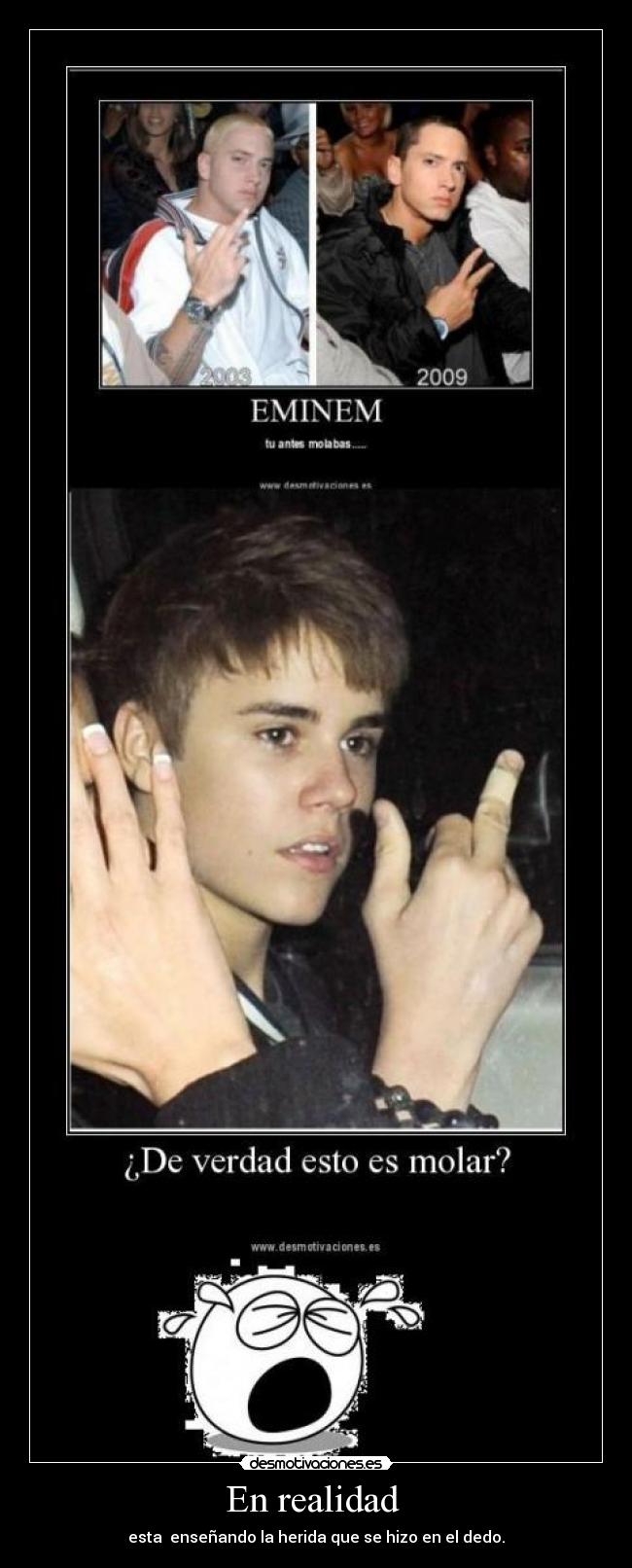 En realidad - esta enseñando la herida que se hizo en el dedo.