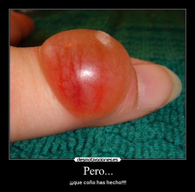 Pero... - ¡¡¡que coño has hecho!!!!