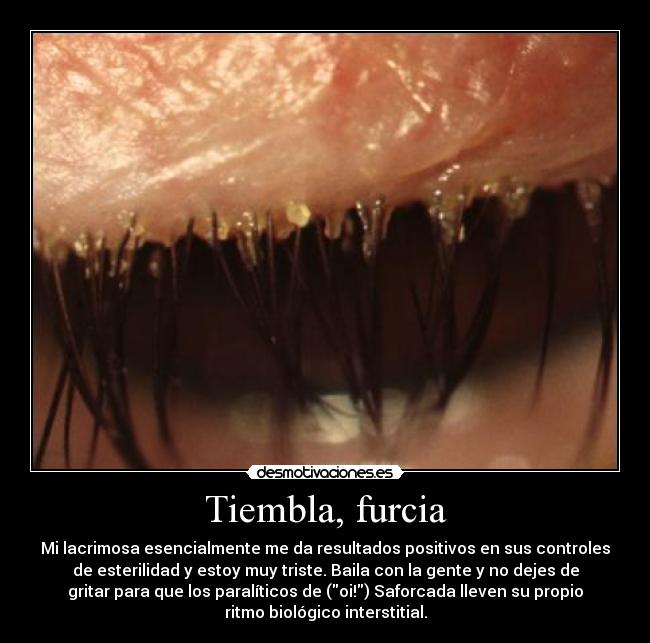 Tiembla, furcia - Mi lacrimosa esencialmente me da resultados positivos en sus controles
de esterilidad y estoy muy triste. Baila con la gente y no dejes de
gritar para que los paralíticos de (oi!) Saforcada lleven su propio
ritmo biológico interstitial.