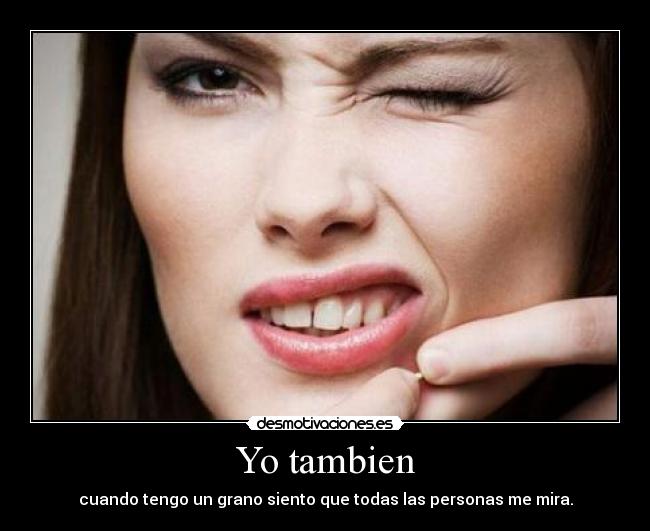 Yo tambien -