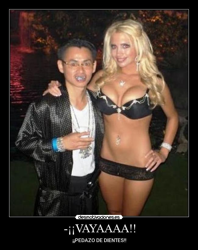 -¡¡VAYAAAA!! - ¡¡PEDAZO DE DIENTES!!