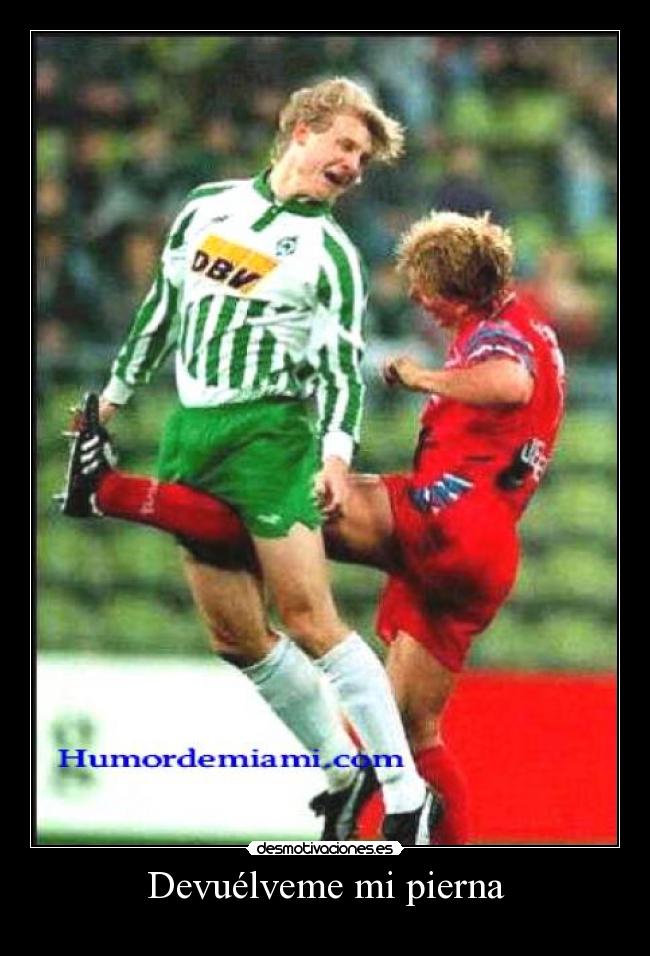 Devuélveme mi pierna -