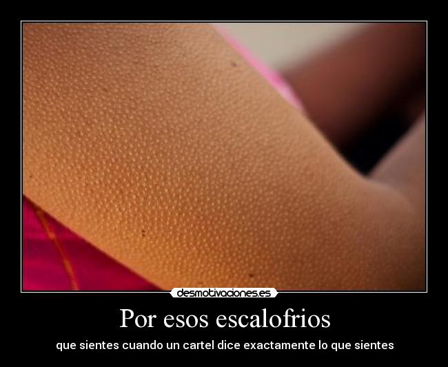 Por esos escalofrios -