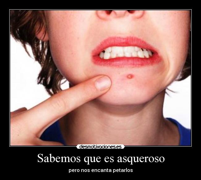 Sabemos que es asqueroso - pero nos encanta petarlos